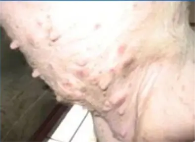 Porcine Circovirus Disease (2).png